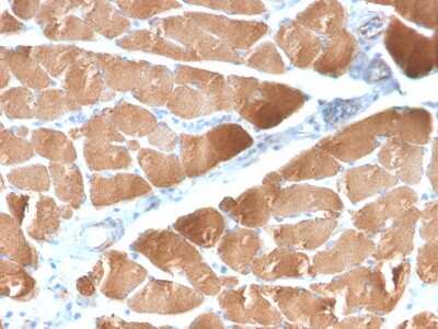 Immunohistochemistry-Paraffin: Desmin Antibody (DES/2960R) - Azide and BSA Free [NBP3-08664]