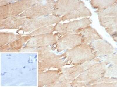 Immunohistochemistry-Paraffin: Desmin Antibody (DES/3255) [NBP3-13866]