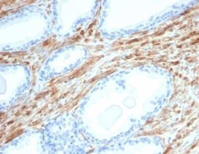 Immunohistochemistry-Paraffin: Desmin Antibody (DES/3255) [NBP3-13866]