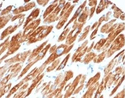 Immunohistochemistry-Paraffin: Desmin Antibody (DES/3255) [NBP3-13866]