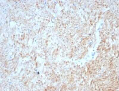 Immunohistochemistry-Paraffin: Desmin Antibody (DES/3255) [NBP3-13866]
