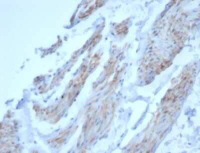 Immunohistochemistry-Paraffin: Desmin Antibody (DES/3255) [NBP3-13866]
