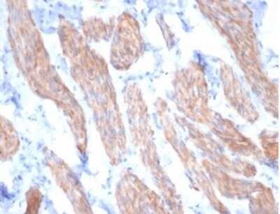 Immunohistochemistry-Paraffin: Desmin Antibody (DES/3255) [NBP3-13866]