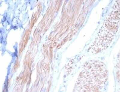 Immunohistochemistry-Paraffin: Desmin Antibody (DES/3255) [NBP3-13866]