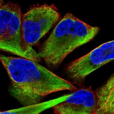 Immunocytochemistry/ Immunofluorescence: Desmin Antibody [NBP1-85549]