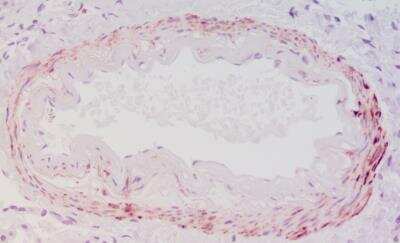 Immunohistochemistry-Paraffin: Desmin Antibody [NBP1-45143]