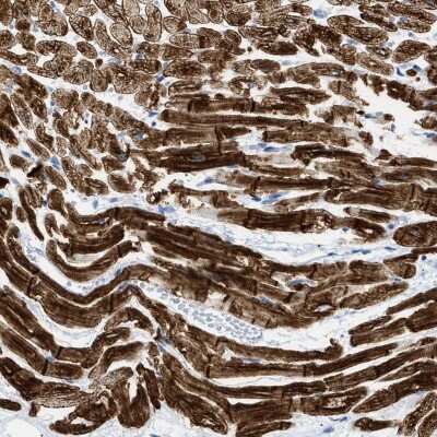 Immunohistochemistry-Paraffin: Desmin Antibody [NBP1-85549]