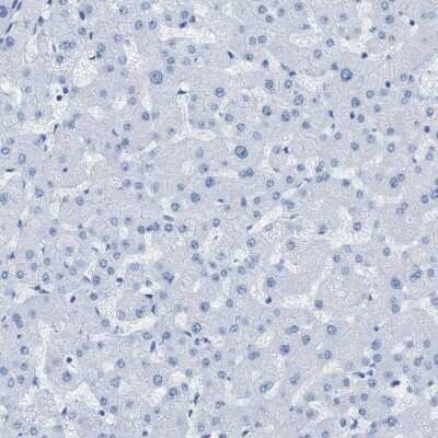 Immunohistochemistry-Paraffin: Desmin Antibody [NBP1-85549]