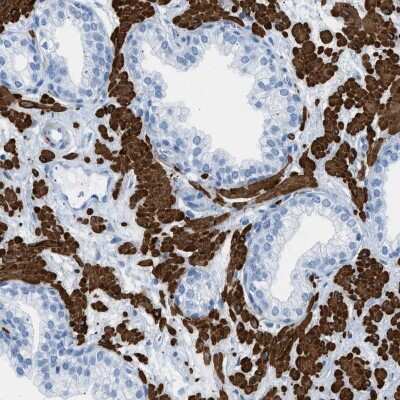 Immunohistochemistry-Paraffin: Desmin Antibody [NBP1-85549]