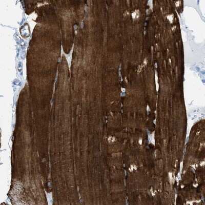 Immunohistochemistry-Paraffin: Desmin Antibody [NBP1-85549]