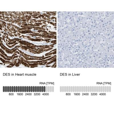 Immunohistochemistry-Paraffin: Desmin Antibody [NBP1-85549]