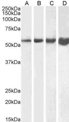 Western Blot: Desmin Antibody [NBP1-45143]