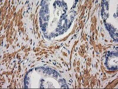 Immunohistochemistry: Desmin Antibody (OTI4G1) - Azide and BSA Free [NBP2-70565]