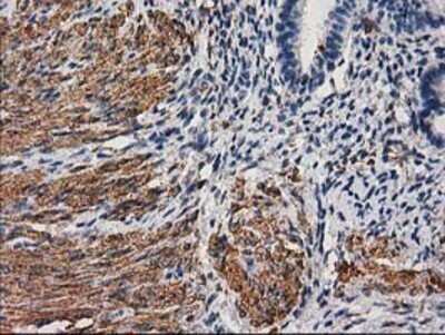 Immunohistochemistry: Desmin Antibody (OTI4G1) - Azide and BSA Free [NBP2-70565]