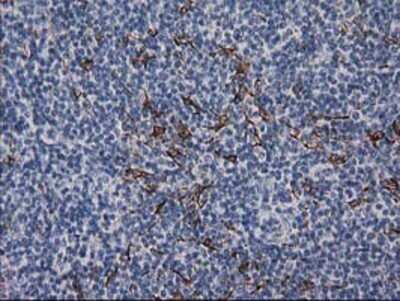 Immunohistochemistry: Desmin Antibody (OTI4G1) - Azide and BSA Free [NBP2-70565]