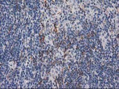 Immunohistochemistry: Desmin Antibody (OTI4G1) - Azide and BSA Free [NBP2-70565]