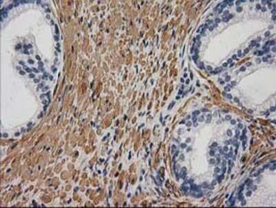 Immunohistochemistry: Desmin Antibody (OTI4G1) - Azide and BSA Free [NBP2-70565]