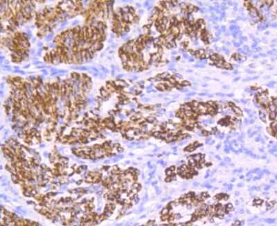 Immunohistochemistry-Paraffin: Desmin Antibody (SI18-00) [NBP2-67407]