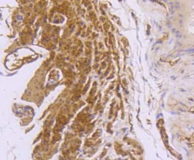 Immunohistochemistry-Paraffin: Desmin Antibody (SI18-00) [NBP2-67407]