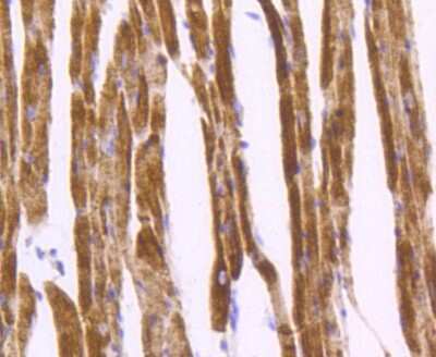 Immunohistochemistry-Paraffin: Desmin Antibody (SI18-00) [NBP2-67407]