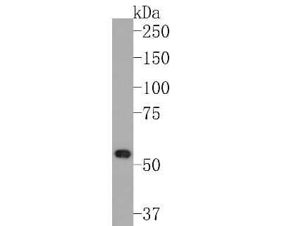 Western Blot: Desmin Antibody (SI18-00) [NBP2-67407]