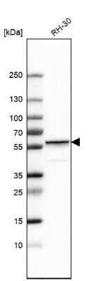 Western Blot: Desmin Antibody [NBP1-85549]