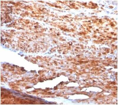 Immunohistochemistry-Paraffin: Desmin Antibody (rDES/1711) [NBP3-13865]