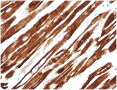 Immunohistochemistry-Paraffin: Desmin Antibody (rDES/1711) [NBP3-13865]