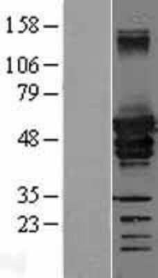 Western Blot: Desmin Overexpression Lysate [NBL1-09840]