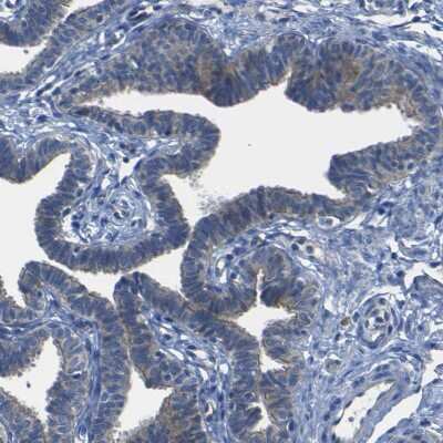 Immunohistochemistry-Paraffin: Desmocollin-1 Antibody [NBP1-88099]