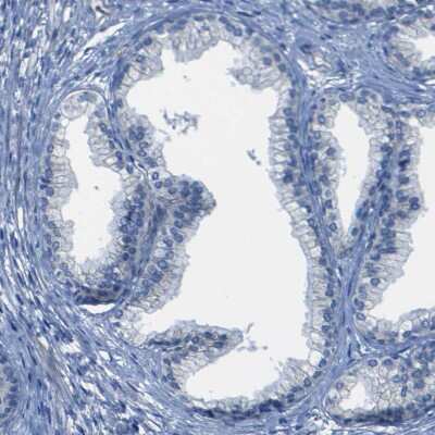 Immunohistochemistry-Paraffin: Desmocollin-1 Antibody [NBP1-88099]