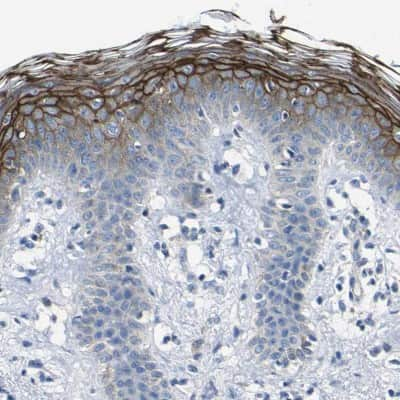 Immunohistochemistry-Paraffin: Desmocollin-1 Antibody [NBP1-88099]