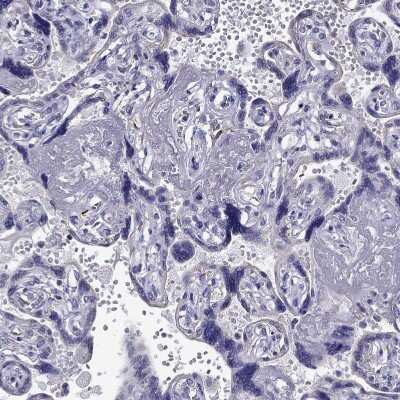 Immunohistochemistry-Paraffin: Desmocollin-1 Antibody [NBP2-62695]