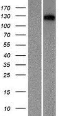 Western Blot: Desmocollin-1 Overexpression Lysate [NBP2-06335]