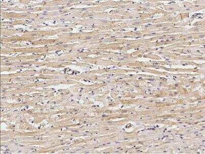 Immunohistochemistry-Paraffin: Desmocollin-2 Antibody (003) [NBP2-90904]