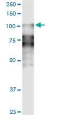 Western Blot: Desmocollin-2 Antibody (1F2) [H00001824-M14]