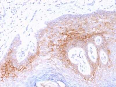 Immunohistochemistry-Paraffin: Desmocollin-2 Antibody (7G6) - Azide and BSA Free [NBP2-54519]