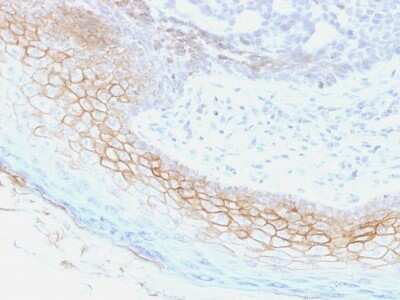 Immunohistochemistry-Paraffin: Desmocollin-2 Antibody (7G6) [NBP2-53378]