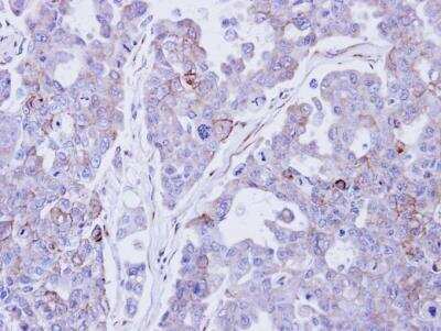 Immunohistochemistry-Paraffin: Desmocollin-2 Antibody [NBP1-32961]