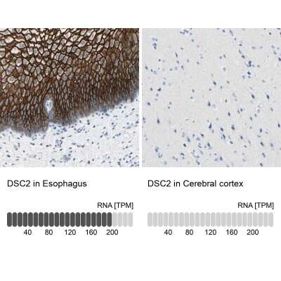 Immunohistochemistry-Paraffin: Desmocollin-2 Antibody [NBP1-85710]