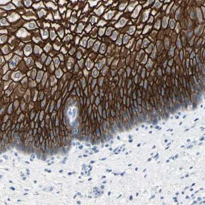 Immunohistochemistry-Paraffin: Desmocollin-2 Antibody [NBP1-85710]