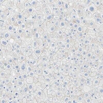 Immunohistochemistry-Paraffin: Desmocollin-2 Antibody [NBP1-85710]