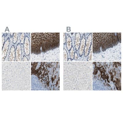 Immunohistochemistry-Paraffin: Desmocollin-2 Antibody [NBP1-85710]