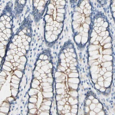 Immunohistochemistry-Paraffin: Desmocollin-2 Antibody [NBP1-85710]