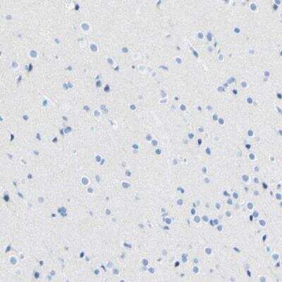 Immunohistochemistry-Paraffin: Desmocollin-2 Antibody [NBP1-85711]