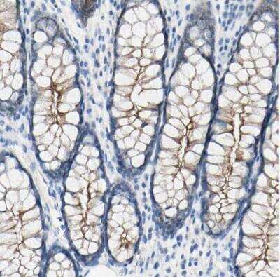 Immunohistochemistry-Paraffin: Desmocollin-2 Antibody [NBP1-85711]