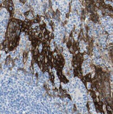 Immunohistochemistry-Paraffin: Desmocollin-2 Antibody [NBP1-85711]
