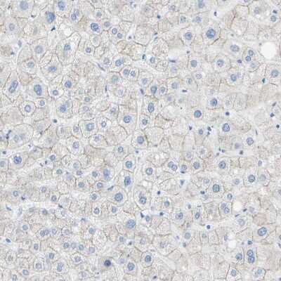 Immunohistochemistry-Paraffin: Desmocollin-2 Antibody [NBP1-85711]