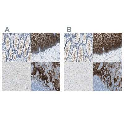 Immunohistochemistry-Paraffin: Desmocollin-2 Antibody [NBP1-85711]