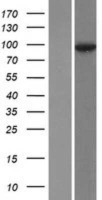 Western Blot: Desmocollin-2 Overexpression Lysate [NBP2-10513]